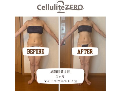 メリッサ(Melissa)の写真