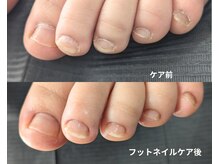 気分が上がるネイルケア☆ブーツの季節のニオイ対策にもおすすめ