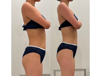 エレン(Elen)/最強ダイエットデトックスコース