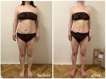 リリィブラン(Lily branc)/痩身/ダイエット