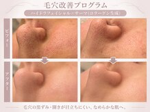 メゾンリュバン 梅田店(Maison Ruban)の雰囲気（毛穴レス♪黒ずみ角栓毛穴開きにワンランク上の高美白毛穴洗浄）