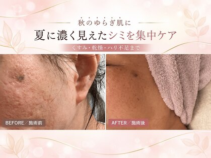 ステラフィールド(stella field)の写真