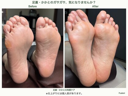 プアラニ(pualani)の写真