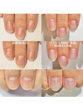 ニコプラス(NICO+)/自爪育成中