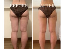 ヨサパーク アーバンヘブン 目黒(YOSA PARK Urban Heaven)/短期期間で集中ダイエット！