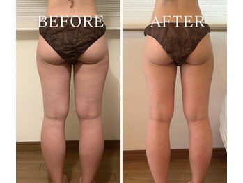 ヨサパーク アーバンヘブン 目黒(YOSA PARK Urban Heaven)/短期期間で集中ダイエット!