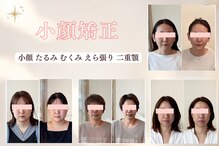 リフェイスフサエ(ReFace Fusae)