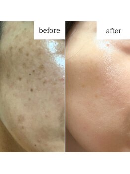 マーギアー(Magier)/ハーブ＋ダーマ