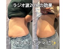 リエル(RIEL)/【ラジオ波エステ】