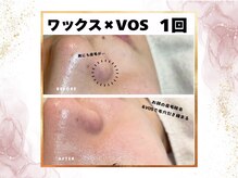 ウェリナポノビューティサロン(welina pono beauty salon)/《小顔/毛穴/脱毛》