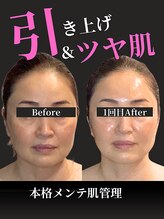 ノーブルノアール(Noble noir)/引き上げ×ツヤ肌