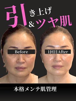 ノーブルノアール(Noble noir)/引き上げ×ツヤ肌