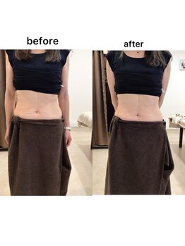 ジョワイユ(Joyeux)/腸の位置でお腹は変わる