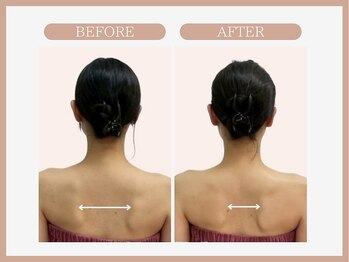 スリムライン 八戸店(The Slim Line)/before→after