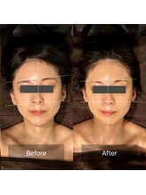 アンド ボナール(&-bonnard)/施術後Before/After 3回施術