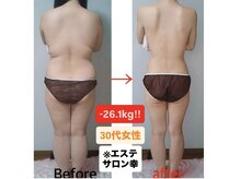 エステサロン 幸