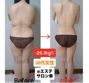 エステサロン 幸