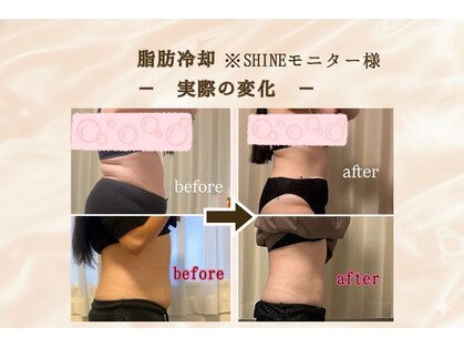 シャイン(SHINE)の写真