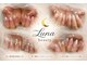 ルナビューティー(Luna beauty)の写真