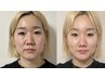 【6月限定！】バストアップ施術＋テラボーラー &nbsp;&nbsp;¥18,000