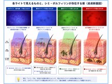 ブレアドール(Blair-Doll)の雰囲気（「大人のシミ・くすみに。肌を見極めて丁寧にケア♪」）