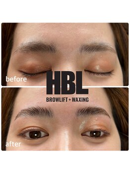 フェリス(FELIZ)/ハリウッドブロウリフト