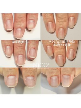 ニコプラス(NICO+)/自爪育成中