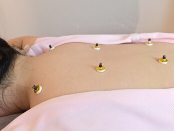 ヨウジョウ サロン ウェル 鴨池院(YOUJOU salon WELL)/ほんわか温かいお灸♪