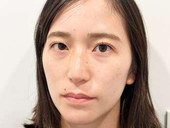 トミー(Tommy)/まつげパーマ