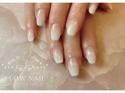 プラウネイル(Plow Nail)の写真