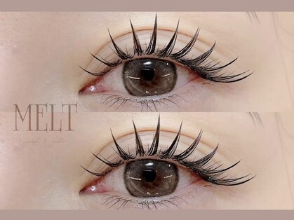 メルト(MELT)の写真