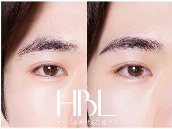リンネ(Rinne)/【HBL】before/after