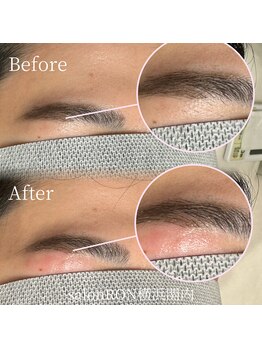 サロンロン 横浜関内(SALON RON)/眉毛脱毛/美容電気脱毛