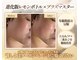 シュシュ(Chouchou)の写真
