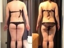 美容整体ウェリナ あま甚目寺院/小顔矯正/骨盤矯正/美脚サロン