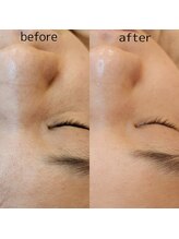 レイネイル レイエステティック 岐阜茜部店(RAY NAIL & RAY ESTHETIC)/カスマラマスク取扱店