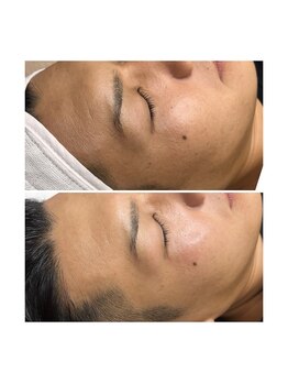 ホワイトワックス 京都四条烏丸(WHITE WAX)/メンズも人気♪清潔感UP↑