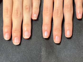 地爪育成 最強ネイルケアコース