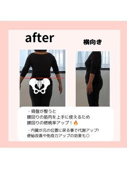 エミフル(EMIFULL)/骨盤の歪み改善で腰回りスッキリ
