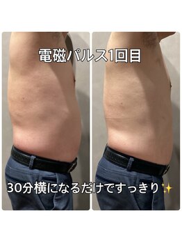 リエル(RIEL)/【電磁パルス】