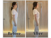 整体ラルース 中目黒(LALUZ)/30代　女性　猫背、巻き肩改善