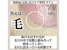 リアン(Riant)/毛穴ケアコース 