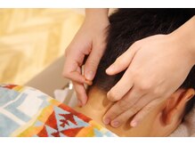 ネイビー鍼灸指圧治療院 那覇久米店(NAVY鍼灸指圧治療院)/【鍼灸メニュー】