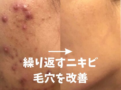 ラポール 野並店(Rapport)の写真