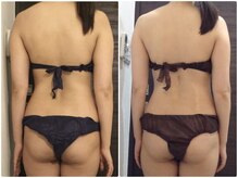 美容整体ウェリナ あま甚目寺院/小顔矯正/骨盤矯正/美脚サロン