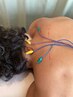【和揉式】局所鍼★30分※妊娠中、妊娠の可能性のある方はお断りしております