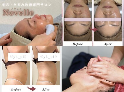 ノヴェル(Novelle)の写真