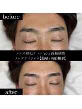 ユー 西船橋店(you)/ビフォーアフター写真