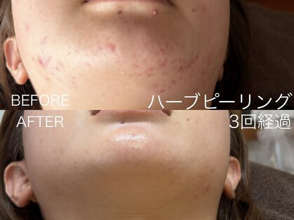 ルーヴレ(LUVRE)の写真