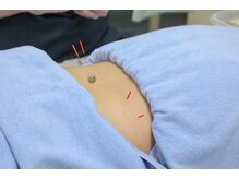本所整骨院の雰囲気(鍼灸)